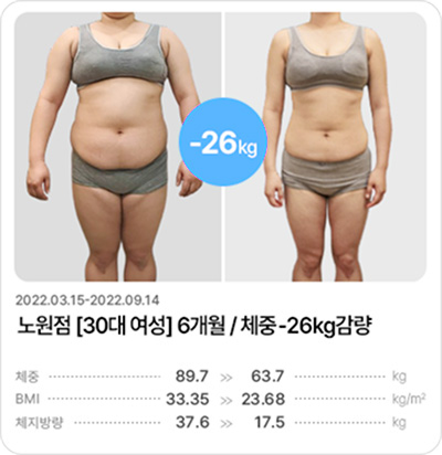 후기 이미지